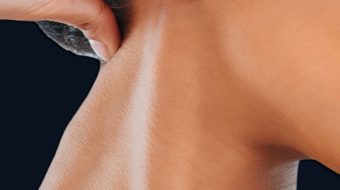 5 - Boyun Düzleşmesi