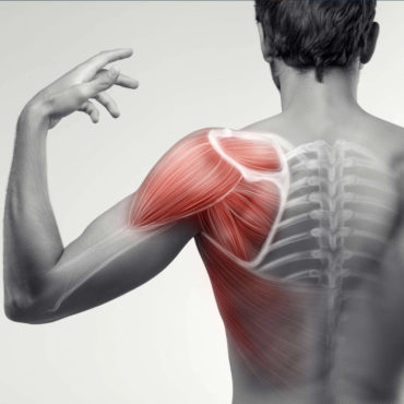 7 - Omuz Bağ Yırtığı