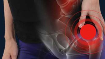 14 - Kalça Sıkışması