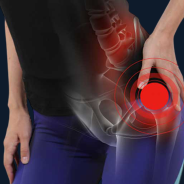 14 - Kalça Sıkışması